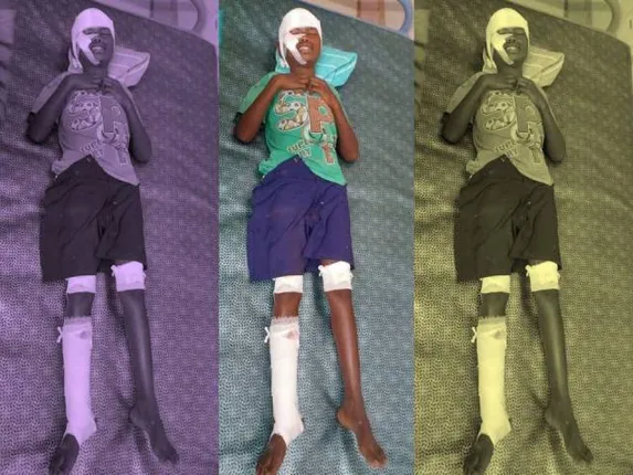 ବୁଲେଟ୍‌ ଧକ୍କାରେ ନାବାଳକ ଆହତ, ସ୍ଥାନାନ୍ତର ସକାଶେ ମିଳିଲାନି ୧୦୮ ଆମ୍ବୁଲାନସ