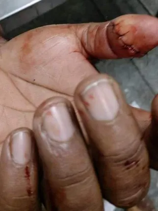 ଗୁଡ଼ି ମାଞ୍ଜା ସୂତାରେ ଯୁବକଙ୍କ ବେକ କଟିଲା