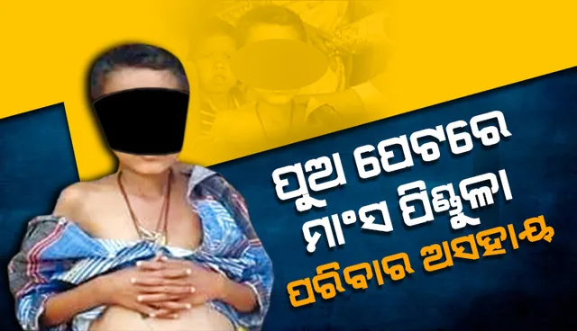 ପୁଅ ପେଟରେ ମାଂସ ପିଣ୍ଡୁଳା: ପରିବାର ଅସହାୟ