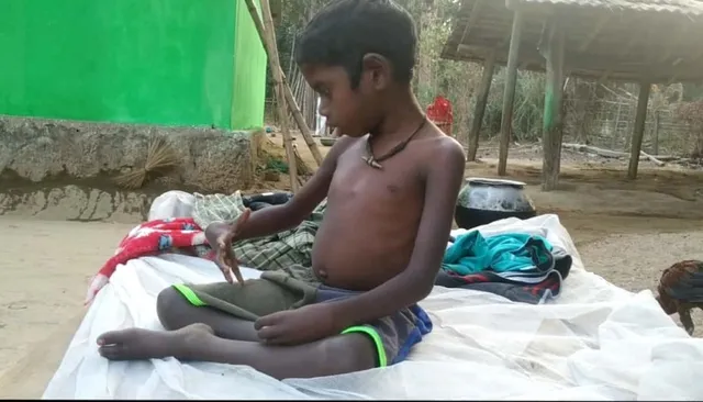 ମହେଶ୍ବର ଅପପୁଷ୍ଟିର ଶିକାର; ଚିକିତ୍ସାରେ ଅର୍ଥ ସାଜିଛି ବାଧକ