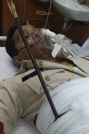 ଫାଣ୍ଡି ଅଧିକାରୀଙ୍କୁ ତୀର ମାଡ଼: ଗୁରୁତର ଅବସ୍ଥାରେ ଆରଜିଏଚରେ ଭର୍ତ୍ତି