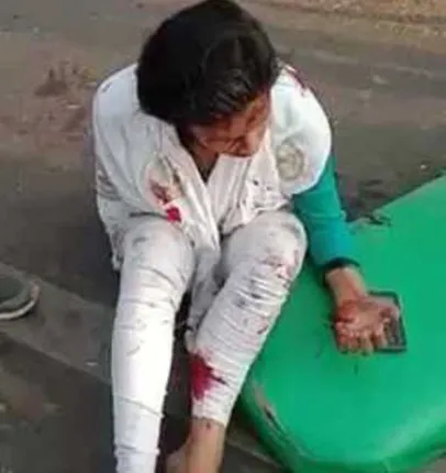 ଭାତପଡ଼ା ଛକରେ ସିରିଜ୍‌ ଦୁର୍ଘଟଣା; ୧୨ ଆହତ, ୨ ଗୁରୁତର; ଶିଶୁ ମୃତ