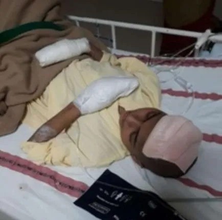 ବର୍ଷେ ହେଲା ମସ୍ତିଷ୍କ ସଂକ୍ରମଣରେ ପଡ଼ିଛନ୍ତି ନିର୍ବାକ ପ୍ରିୟଙ୍କା; ଚିକିତ୍ସାରେ ଅର୍ଥ ବାଧକ, ସହାୟତା ପାଇଁ ନିବେଦନ