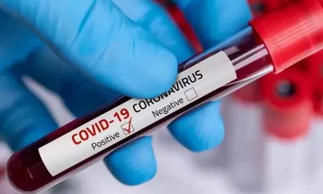 ଜାଲ୍‌ କୋଭିଡ୍‌ ପଜିଟିଭ୍‌ ରି‌ପୋର୍ଟ ପ୍ରସଙ୍ଗ: ଦଲାଲ୍‌ଙ୍କ ଭିତରେ କୋକୁଆଭୟ, ଉତ୍ତର ରଖିଲା ସଂସ୍ଥା