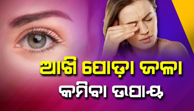 ଏଭଳି କଲେ କମିଥାଏ ଆଖି ପୋଡ଼ା ଜଳା, ଆପଣାନ୍ତୁ ଏହି ସବୁ ଘରୋଇ ଉପାୟ