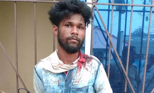 ଛିନତାଇ ପ୍ରତିରୋଧ ବେଳେ ଛୁରିମାଡ଼: ଜଣେ ଗୁରୁତର