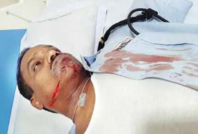 ଲୁଟେରାଙ୍କ ଉତ୍ପାତ : ସୁରକ୍ଷାକର୍ମୀଙ୍କ ବେକ କାଟିଦେଲେ