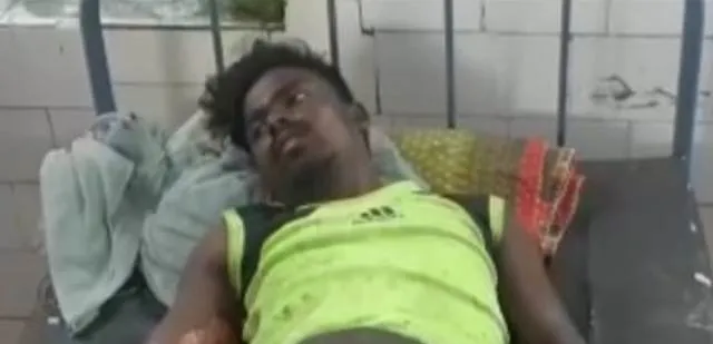 ଜଙ୍ଗଲରେ ନିଆଁ ଲିଭାଉଥିବା ବେଳେ ଜଳିଲେ ୱାଚର, ଗୁରୁତର ଅବସ୍ଥାରେ ହସ୍ପିଟାଲରେ ଭର୍ତ୍ତି