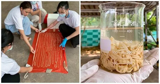 ବୃଦ୍ଧଙ୍କ ପେଟରେ‌ ହେଉଥିଲା ଯନ୍ତ୍ରଣା, ଡାକ୍ତର ଗୁପ୍ତାଙ୍ଗରୁ ବାହାର କଲେ ୫୯ଫୁଟର ପୋକ !