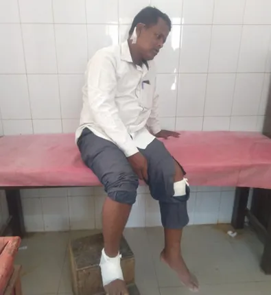 ଦାଦାବଟି ନ ଦେବାରୁ ବ୍ଲକ୍‌ ଉପାଧ୍ୟକ୍ଷଙ୍କୁ ଆକ୍ରମଣ