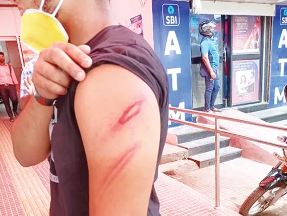 ଛାତ୍ରଙ୍କୁ ବାଡ଼େଇ ହାତ ଭାଙ୍ଗିଦେଲେ ସିନିଅର