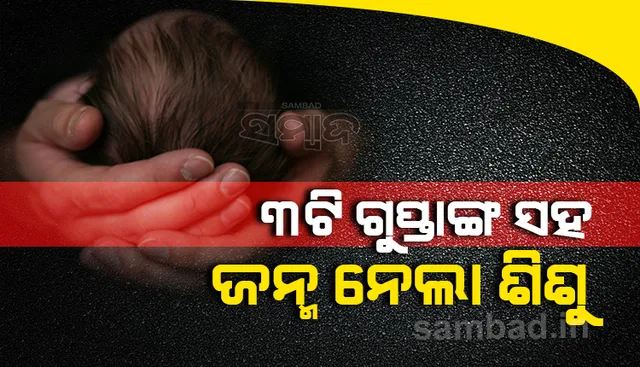 ବିଶ୍ବରେ ପ୍ରଥମ : ୩ଟି ଗୁପ୍ତାଙ୍ଗ ସହ ଜନ୍ମ ନେଲା ଶିଶୁ ପୁତ୍ର
