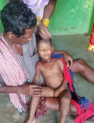 କୁକୁର ଦଳ ଆକ୍ରମଣରେ ୫ ବର୍ଷର ଶିଶୁ ମୃତ