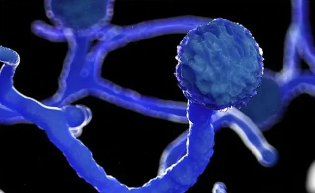 କୋଭିଡ ନ ଥାଇ ବ୍ଲାକ୍ ଫଙ୍ଗସ୍‌ରେ ୪୯ ଆକ୍ରାନ୍ତ: ମହିଳାଙ୍କ ତୁଳନାରେ ଅଧିକ ପୁରୁଷ ଆକ୍ରାନ୍ତ