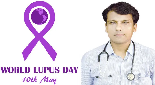 ଆଜି ବିଶ୍ବ ଲୁପସ୍‌ ଦିବସ: ପ୍ରତି ୧୦ ଜଣରେ ୯ ଜଣ ମହିଳା ଲୁପସ୍‌ ରୋଗୀ