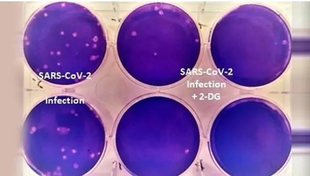 ଡିଆରଡିଓ ପ୍ରସ୍ତୁତ ୨-ଡିଜି କରୋନାର ସବୁ ପ୍ରକାରର ଭାରିଆଣ୍ଟ ବିରୋଧରେ ପ୍ରଭାବୀ : ଗବେଷଣା