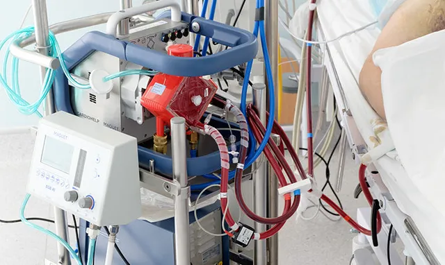 ଭୁବନେଶ୍ୱର ଏମ୍ସରେ ଖୁବଶୀଘ୍ର ସ୍ଥାପନ ହେବ ଦୁଇଟି ECMO ମେସିନ, ଖୁବଶୀଘ୍ର ଆରମ୍ଭ ହେବ ଚିକିତ୍ସା