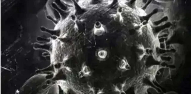 ଜଣେ ରୋଗୀଙ୍କ ଶରୀରରୁ ବ୍ଲାକ୍, ହ୍ବାଇଟ ଓ ୟେଲୋ ଫଙ୍ଗସ ଚିହ୍ନଟ; ଅସ୍ତ୍ରୋପଚାର ପାଇଁ ଲାଗିଲା ତିନିଘଣ୍ଟା