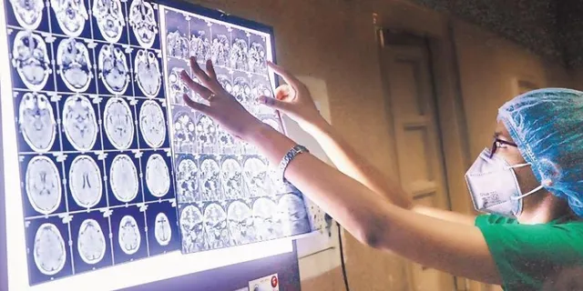 ମଧ୍ୟପ୍ରଦେଶରେ ବ୍ଲାକ ଫଙ୍ଗସରେ ଆକ୍ରାନ୍ତ ହୋଇ ୨୦ଦିନରେ ଗଲାଣି ୩୨ଜଣଙ୍କ ଜୀବନ