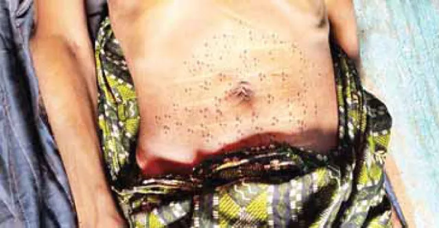 ଅନ୍ଧବିଶ୍ବାସର କୁପରିଣତି: ଯୁବକଙ୍କୁ ୫ ଶହ ଚେଙ୍କ, ଶେଷ‌ରେ ଜୀବନ ଗଲା