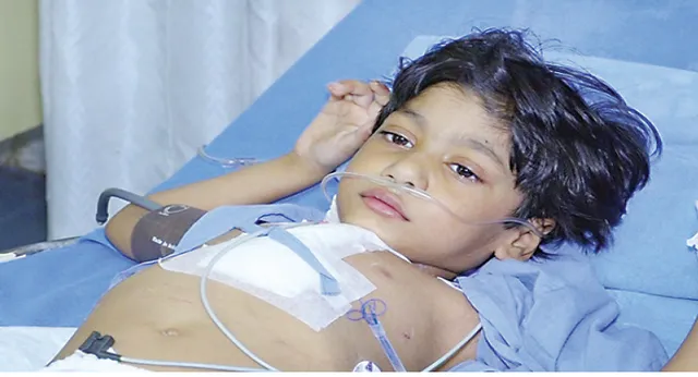 ହାଇଟେକ୍‌ ହସ୍ପିଟାଲରେ ୬ ଶିଶୁଙ୍କ ବିରଳ ଅସ୍ତ୍ରୋପଚାର