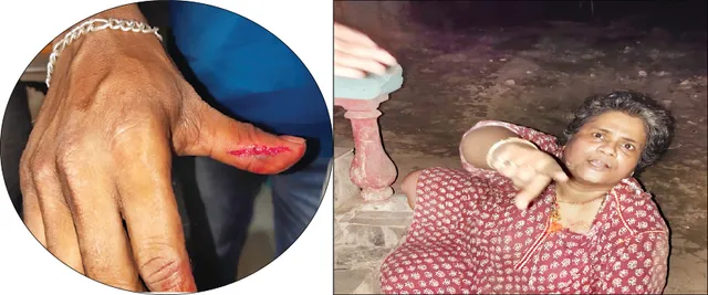 ମହିଳାଙ୍କ ଉନ୍ମତ୍ତ କାଣ୍ଡ; ମହିଳା ପୁଲିସ ଏସ୍‌ଆଇଙ୍କୁ ବାଡ଼େଇଲେ, କାମୁଡ଼ିଲେ