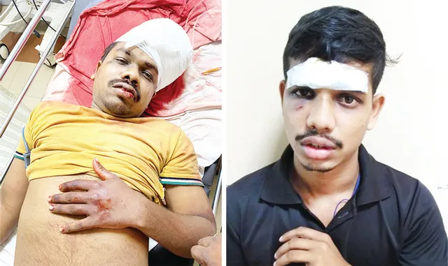 ଆତଙ୍କ ଖେଳାଇଲେ ଫାଇନାନ୍ସ କର୍ମଚାରୀ, ୨ ଭାଇଙ୍କ ମୁଣ୍ଡକୁ ଖଣ୍ଡା ଚୋଟ