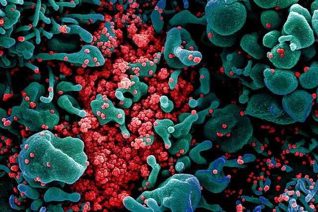 ୨୪ ଘଣ୍ଟା ମଧ୍ୟରେ ଦେଶରେ ୧୮,୮୭୦ ନୂଆ କୋଭିଡ୍‌-୧୯ ସଂକ୍ରମିତ ଚିହ୍ନଟ; ମୃତ୍ୟୁସଂଖ୍ୟା ୩୭୮