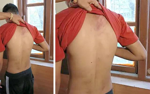 ସହପାଠୀଙ୍କ ମାଡ଼ରେ ଭିସୁଟ୍‌ ଛାତ୍ର ଗୁରୁତର, ଡାକ୍ତରଖାନାରେ ଭର୍ତ୍ତି