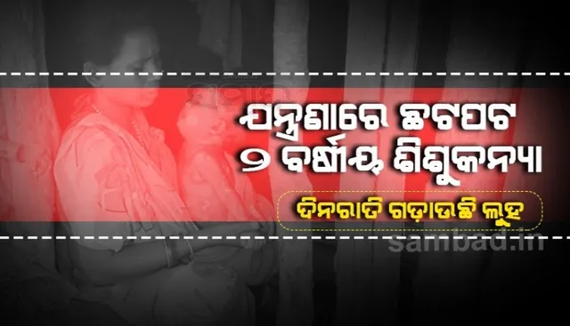 ଜନ୍ମରୁ ଚର୍ମ ଯନ୍ତ୍ରଣାରେ ଛଟପଟ, ଦିନରାତି କାନ୍ଦୁଛି ୨ବର୍ଷର ଝିଅ ତାରା