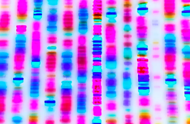 ଡିଏନଏ ପରୀକ୍ଷା ପାଇଁ ଜଣେ ବ୍ୟକ୍ତିଙ୍କୁ ବାଧ୍ୟ କରାଯାଇପାରିବ ନାହିଁ: ସୁପ୍ରିମକୋର୍ଟ