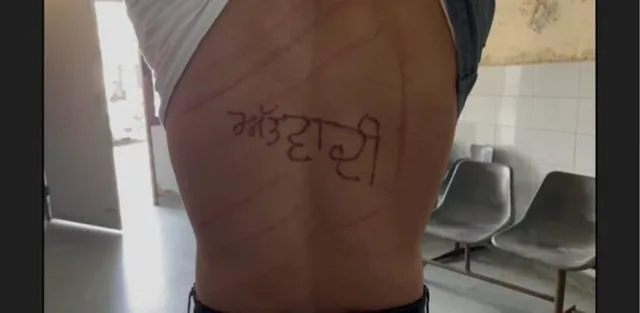 ଜେଲର କଏଦୀଙ୍କ ପିଠିରେ ଗରମ ଲୁହାରେ ଲେଖିଲେ ‘ଆତଙ୍କବାଦୀ’