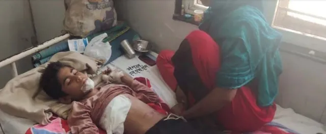 ମୋବାଇଲ ବ୍ୟାଟେରୀ ବିସ୍ଫୋରଣରେ ୧୨ବର୍ଷର ବାଳକ ଗୁରୁତର; ଜୀବନ ମରଣ ସହ କରୁଛି ସଂଘର୍ଷ