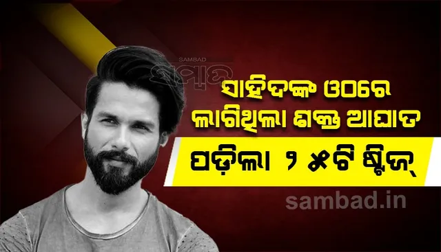 ସୁଟିଂ ସମୟରେ ସାହିଦଙ୍କ ଓଠ ଓ ହାତରେ ଲାଗିଥିଲା ଆଘାତ, ପଡ଼ିଲା ୨୫ଟି ଷ୍ଟିଜ