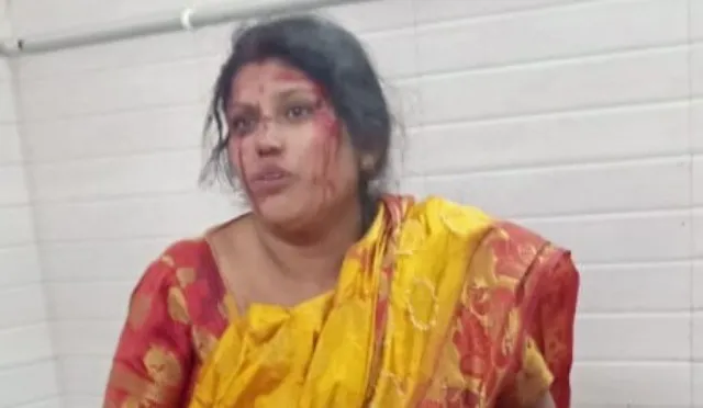 ମହିଳାଙ୍କ ବେକରୁ ଝାମ୍ପିନେଲେ ସୁନାଚେନ୍‌; ପଡିଯାଇ ମହିଳା ଆହତ, ଡାକ୍ତରଖାନାରେ ଭର୍ତ୍ତି 