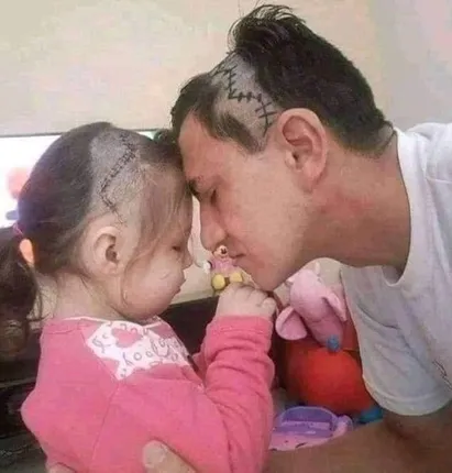 ମସ୍ତିଷ୍କ ଅସ୍ତ୍ରୋପଚାର ପରେ ଝିଅକୁ ଖୁସି କରିବା ପାଇଁ ବାପା ନେଲେ ଏଭଳି ପଦକ୍ଷେପ