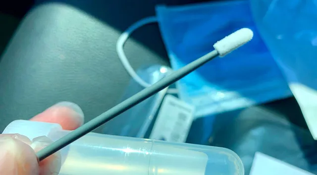 ଓଡ଼ିଶାରେ ଆଜି ପହଞ୍ଚିବ ଓମିସିଓର କିଟ୍‌