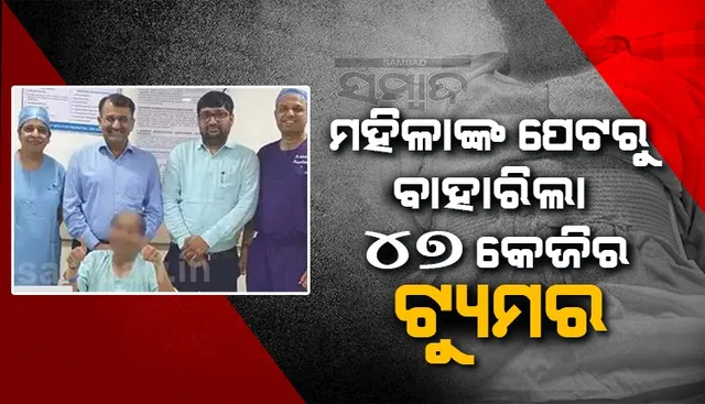 ୧୮ ବର୍ଷ ପରେ ମହିଳାଙ୍କ ପେଟରୁ ବାହାରିଲା ୪୭କେଜିର ଟ୍ୟୁମର