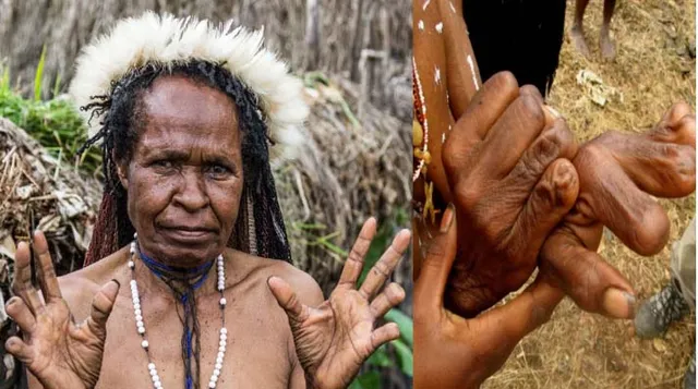 ଆତ୍ମୀୟଙ୍କ ମୃତ୍ୟୁ ପରେ ମହିଳା କାଟି ଦେଇଥାଆନ୍ତି ନିଜ ଆଙ୍ଗୁଠି