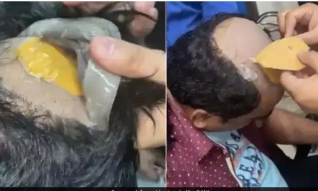 କେଶ ତଳେ ସୁନା ଲୁଚାଇ ନେଉଥିବା ବେଳେ ଧରାପଡ଼ିଲେ ଯୁବକ