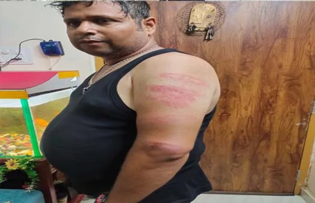 ଯୁବକଙ୍କୁ ଅପହରଣ କରି ପ୍ରାଣାନ୍ତକ ଆକ୍ରମଣ: ଗାଡ଼ି ମାଲିକଙ୍କ ନାଁରେ ମାମଲା