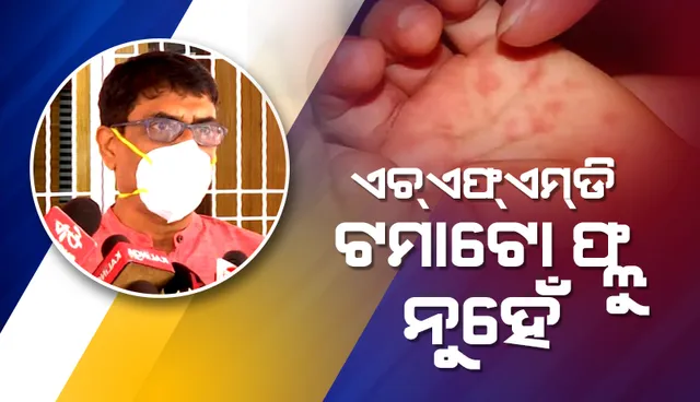 ଏଚଏଫଏମଡି ପାଇଁ ଆତଙ୍କିତ ହେବାର ଆବଶ୍ୟକତା ନାହିଁ: ସ୍ବାସ୍ଥ୍ୟ ନିର୍ଦ୍ଦେଶକ ବିଜୟ ମହାପାତ୍ର