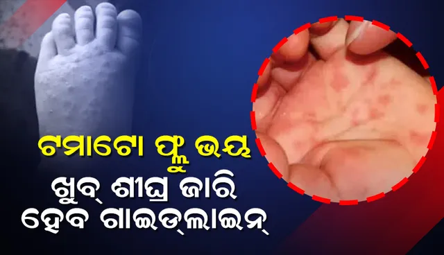 ଟମାଟୋ ଫ୍ଲୁ ଭୟ: ଖୁବଶୀଘ୍ର ଜାରି ହେବ ନମୁନା ସଂଗ୍ରହ ଗାଇଡଲାଇନ୍