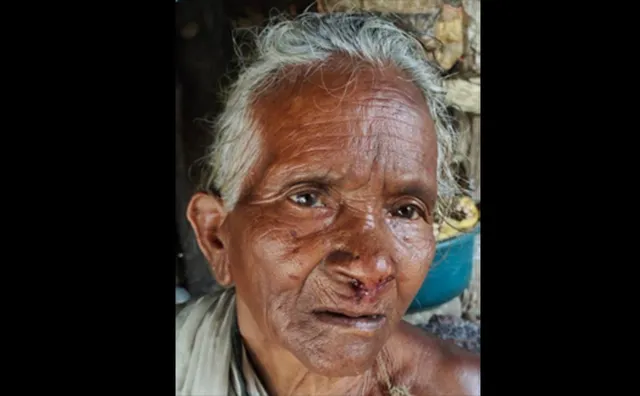 ବୃଦ୍ଧାଙ୍କ ବେକରୁ ସୁନା ଅଳଙ୍କାର ଝାମ୍ପିନେଲେ ଦୁର୍ବୃତ୍ତ