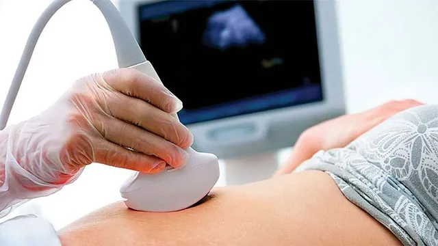 ବେଆଇନ୍ ଲିଙ୍ଗ ନିରୂପଣ ମାମଲା: ଡାକ୍ତରଙ୍କ ବିରୋଧରେ ଏନ୍‌ବିଡବ୍ଲୁ