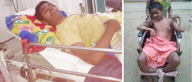 ୪ ବର୍ଷ ଧରି କୋମାରେ ନାବାଳକ