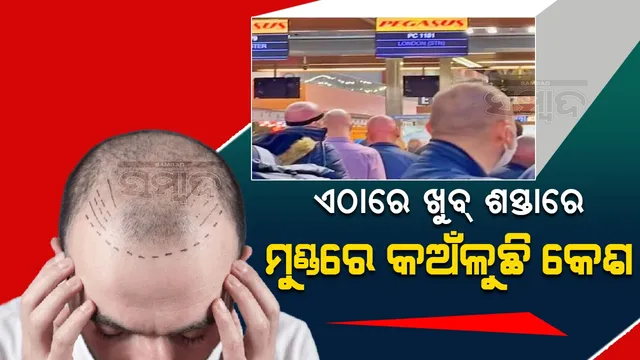 ଏଠାରେ କେଶ ପ୍ରତିରୋପଣ ପାଇଁ ଇଚ୍ଛୁକ ବ୍ୟକ୍ତିଙ୍କୁ ଯୋଗା ଯାଉଛି ସବୁ ସୁବିଧା, ଅଳ୍ପ ଦରରେ କଳା ମୁଚୁମୁଚୁ ହେବ ମୁଣ୍ଡ