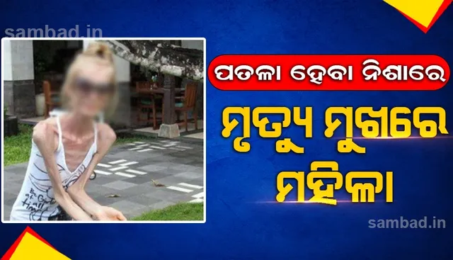 ଅତିରୁ ଇତି: ଅତ୍ୟଧିକ ଓଜନ ହ୍ରାସ କରି ମୃତ୍ୟୁ ମୁଖରେ ମହିଳା