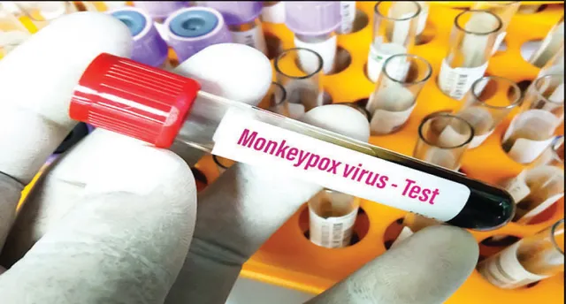 ‘ହୁ’ର ଘୋଷଣା: ମଙ୍କିପକ୍ସ ବିଶ୍ବର ସ୍ବାସ୍ଥ୍ୟ ସଙ୍କଟ, ବିଶ୍ବବ୍ୟାପୀ ୧୬ ହଜାରରୁ ଅଧିକ ମଙ୍କିପକ୍ସ ମାମଲା
