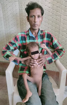 ଶିଶୁ ଅପପୁଷ୍ଟି ଶିକାର ଘଟଣା, ଶିଶୁଭବନରେ ଭର୍ତ୍ତି କରିବାକୁ ନିର୍ଦ୍ଦେଶ